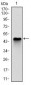 NQO1 Antibody
